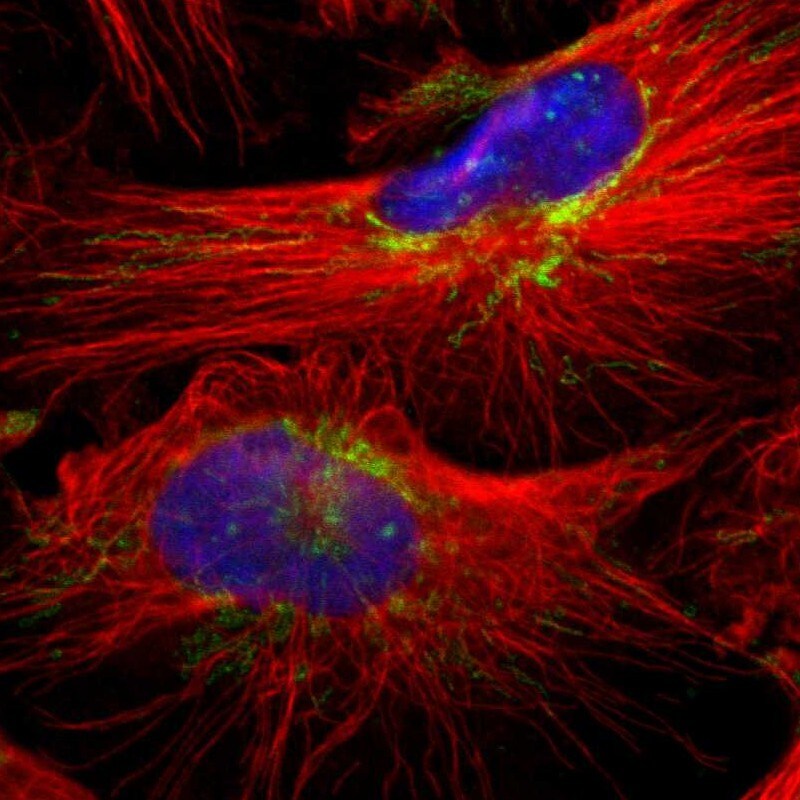 MRPL40 Antibody - BSA Free Immunocytochemistry/ Immunofluorescence: MRPL40 Antibody [NBP1-82620]