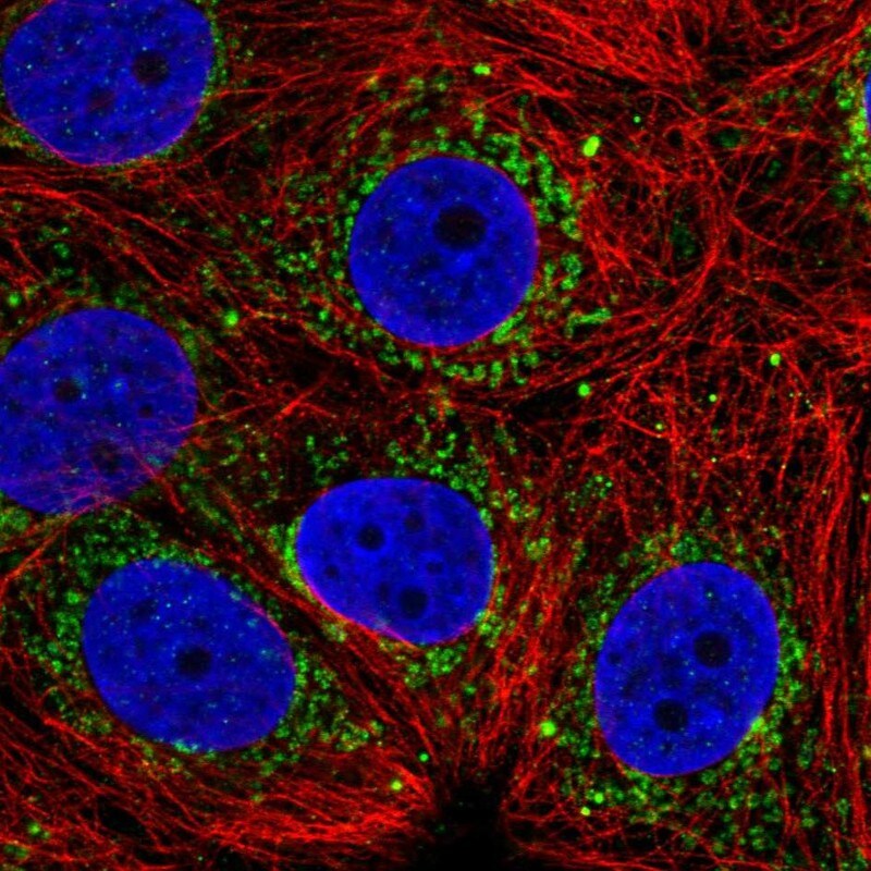 ALDH6A1 Antibody - BSA Free Immunocytochemistry/ Immunofluorescence: ALDH6A1 Antibody [NBP1-82634]