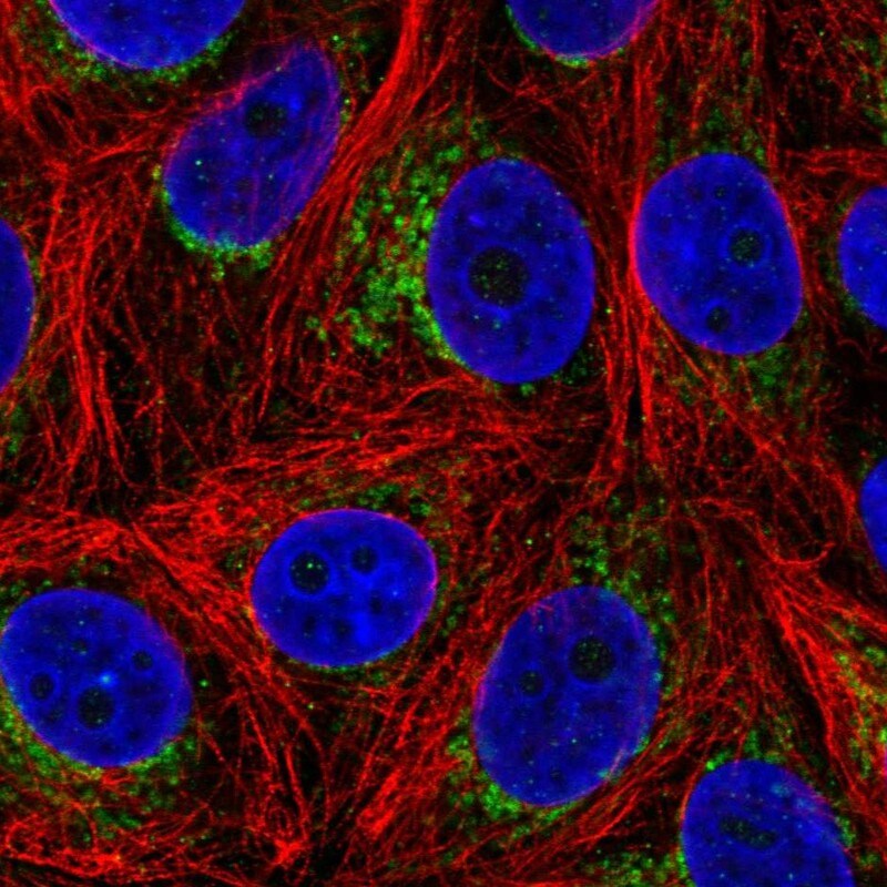 ALDH6A1 Antibody - BSA Free Immunocytochemistry/ Immunofluorescence: ALDH6A1 Antibody [NBP1-82636]