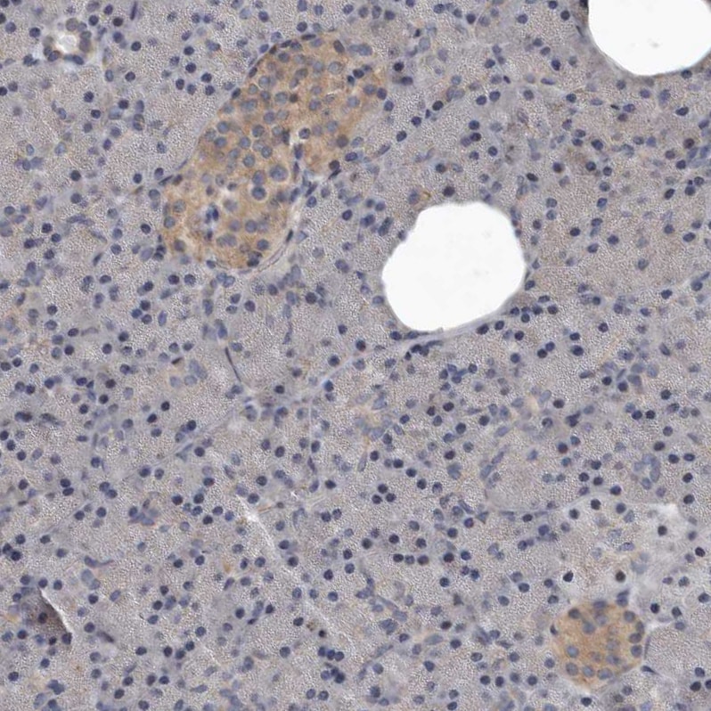 DHPS Antibody - BSA Free Immunohistochemistry-Paraffin: DHPS Antibody [NBP1-82648]