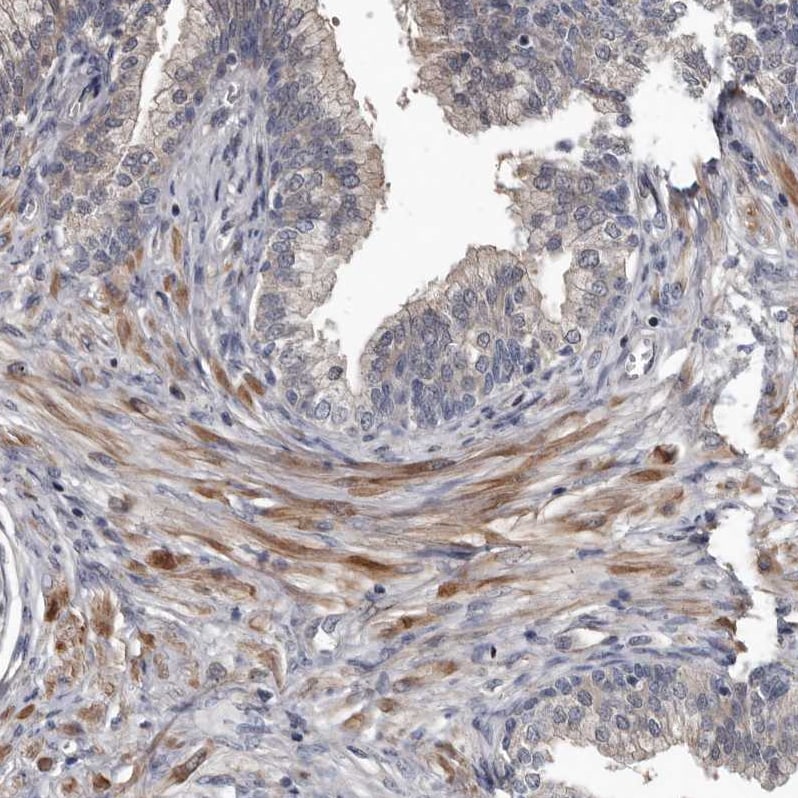 DHPS Antibody - BSA Free Immunohistochemistry-Paraffin: DHPS Antibody [NBP1-82648]