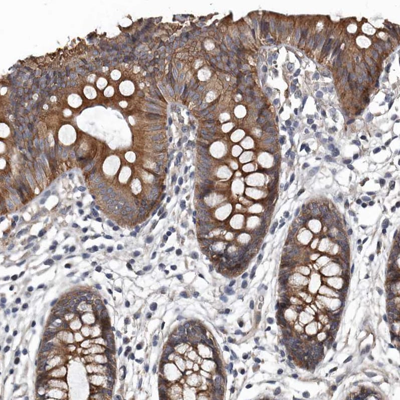 DHPS Antibody - BSA Free Immunohistochemistry-Paraffin: DHPS Antibody [NBP1-82648]