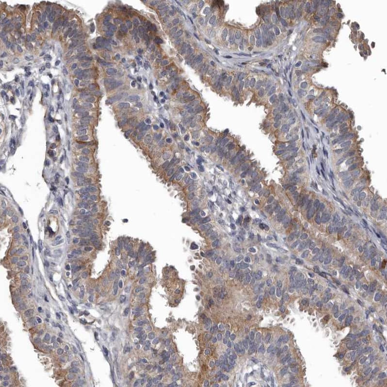 DHPS Antibody - BSA Free Immunohistochemistry-Paraffin: DHPS Antibody [NBP1-82648]