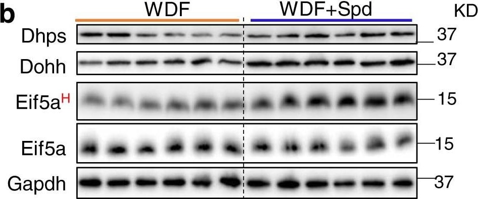 DHPS Antibody - BSA Free