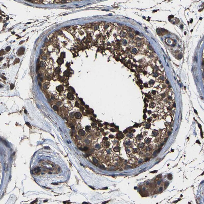 DHPS Antibody - BSA Free Immunohistochemistry-Paraffin: DHPS Antibody [NBP1-82649]