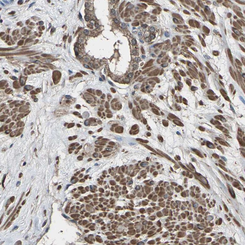 DHPS Antibody - BSA Free Immunohistochemistry-Paraffin: DHPS Antibody [NBP1-82649]