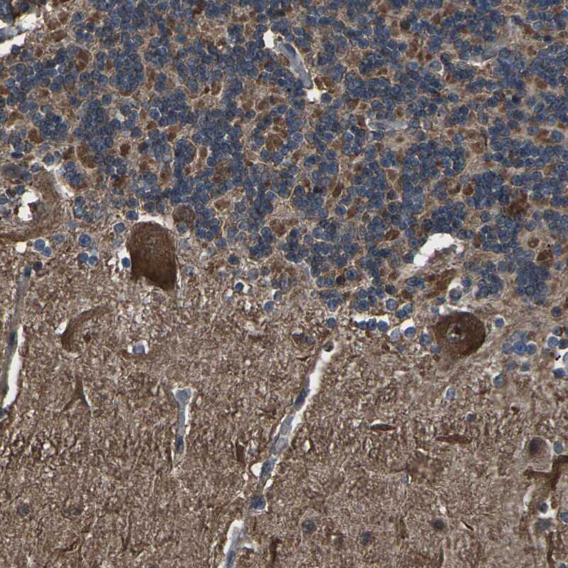 DHPS Antibody - BSA Free Immunohistochemistry-Paraffin: DHPS Antibody [NBP1-82649]