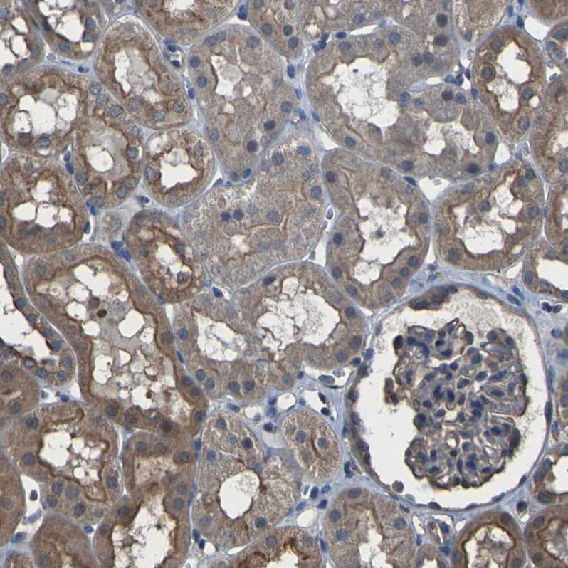 DHPS Antibody - BSA Free Immunohistochemistry-Paraffin: DHPS Antibody [NBP1-82649]