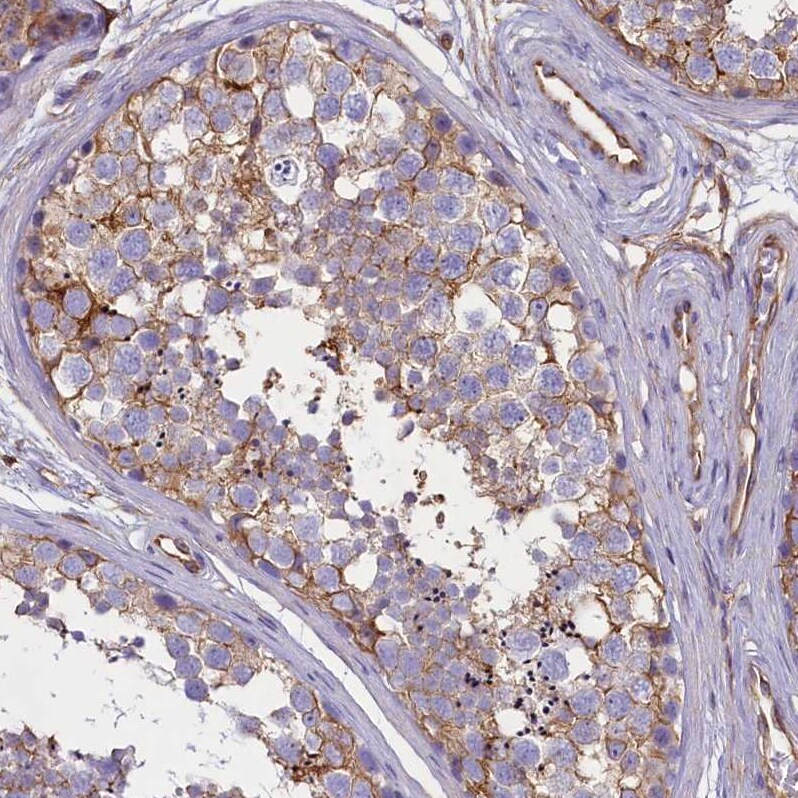 CD99 Antibody - BSA Free Immunohistochemistry-Paraffin: CD99 Antibody [NBP1-82650]