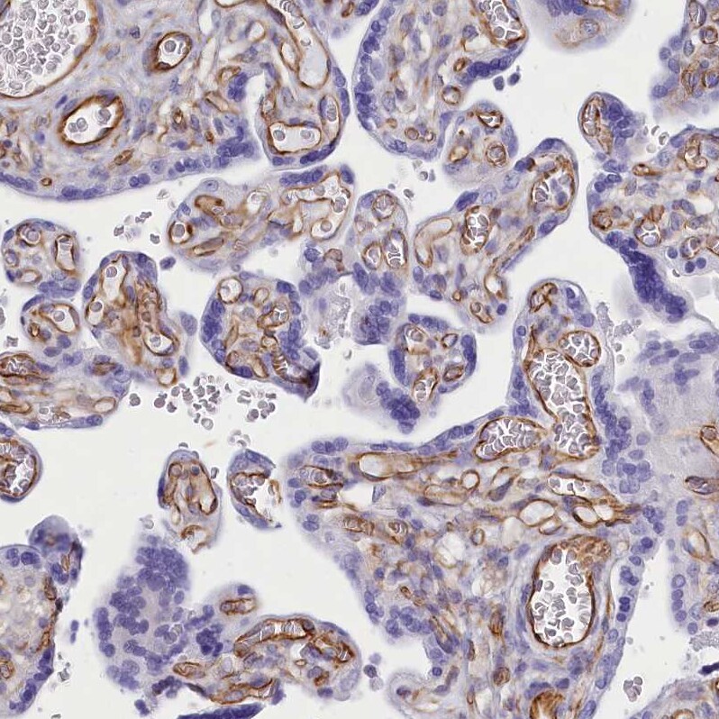 CD99 Antibody - BSA Free Immunohistochemistry-Paraffin: CD99 Antibody [NBP1-82650]