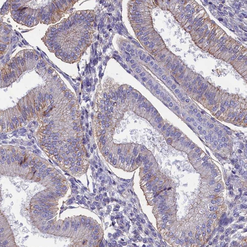 CD99 Antibody - BSA Free Immunohistochemistry-Paraffin: CD99 Antibody [NBP1-82650]