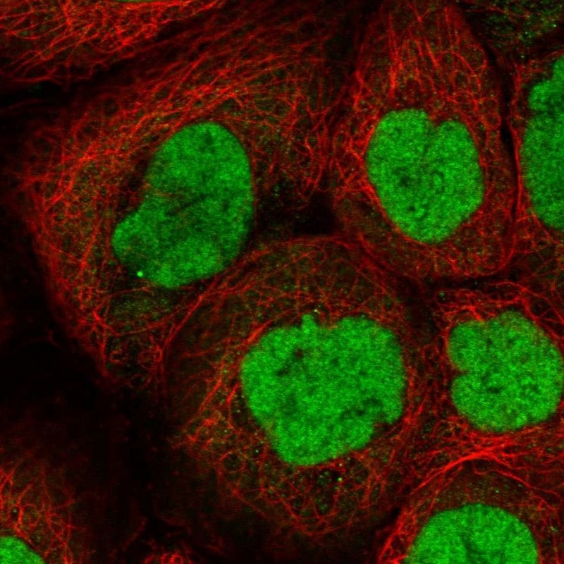 CHD4 Antibody - BSA Free Immunocytochemistry/ Immunofluorescence: CHD4 Antibody [NBP1-82651]