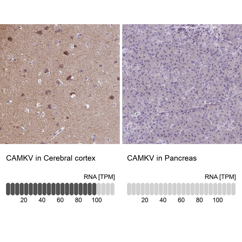 CaMKV Antibody - BSA Free Immunohistochemistry-Paraffin: CaMKV Antibody [NBP1-82660]