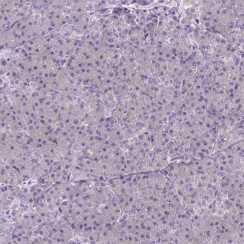 CaMKV Antibody - BSA Free Immunohistochemistry-Paraffin: CaMKV Antibody [NBP1-82660]