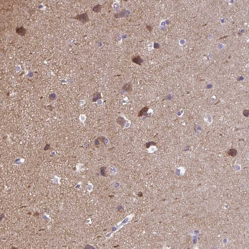 CaMKV Antibody - BSA Free Immunohistochemistry-Paraffin: CaMKV Antibody [NBP1-82660]