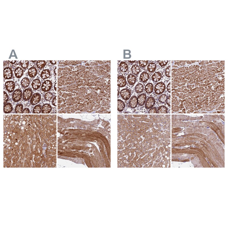 NDUFA8 Antibody Immunohistochemistry-Paraffin: NDUFA8 Antibody Antibody [NBP1-82662]