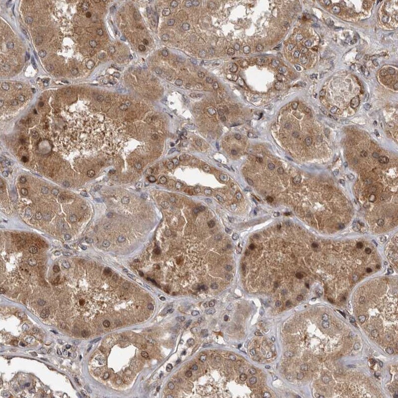 CCDC190 Antibody - BSA Free Immunohistochemistry-Paraffin: CCDC190 Antibody [NBP1-82674]