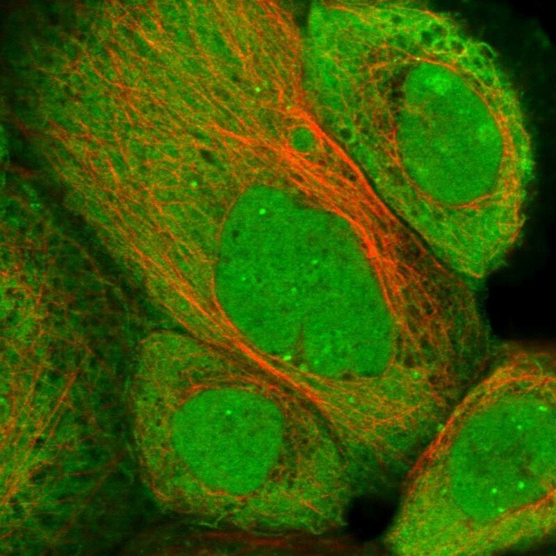 ZNF276 Antibody - BSA Free Immunocytochemistry/ Immunofluorescence: ZNF276 Antibody [NBP1-82681]