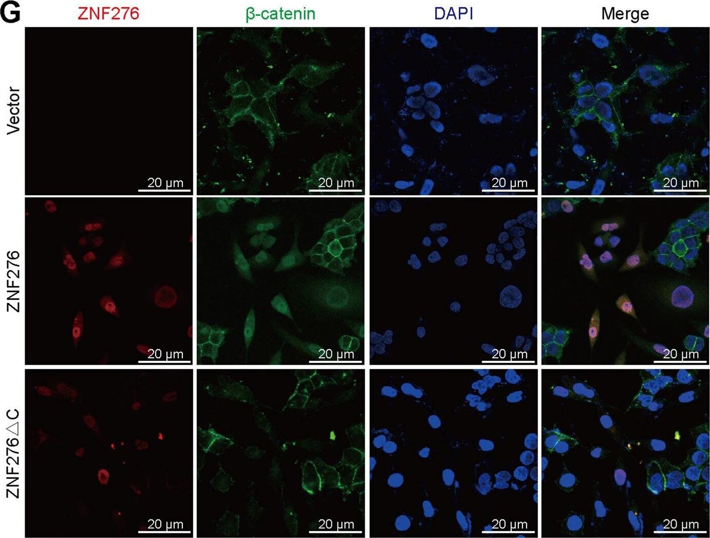 ZNF276 Antibody - BSA Free