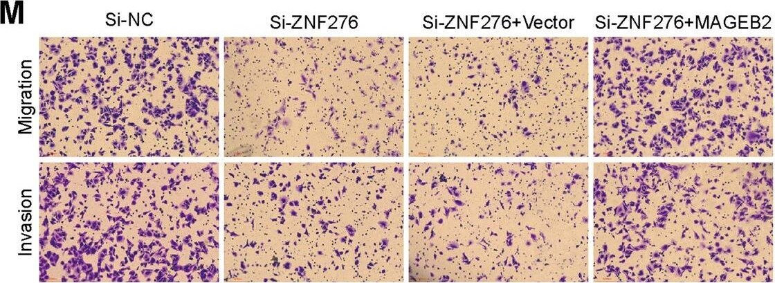 ZNF276 Antibody - BSA Free