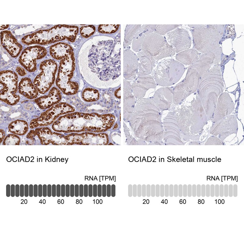 OCIAD2 Antibody - BSA Free Immunohistochemistry-Paraffin: OCIAD2 Antibody [NBP1-82683]