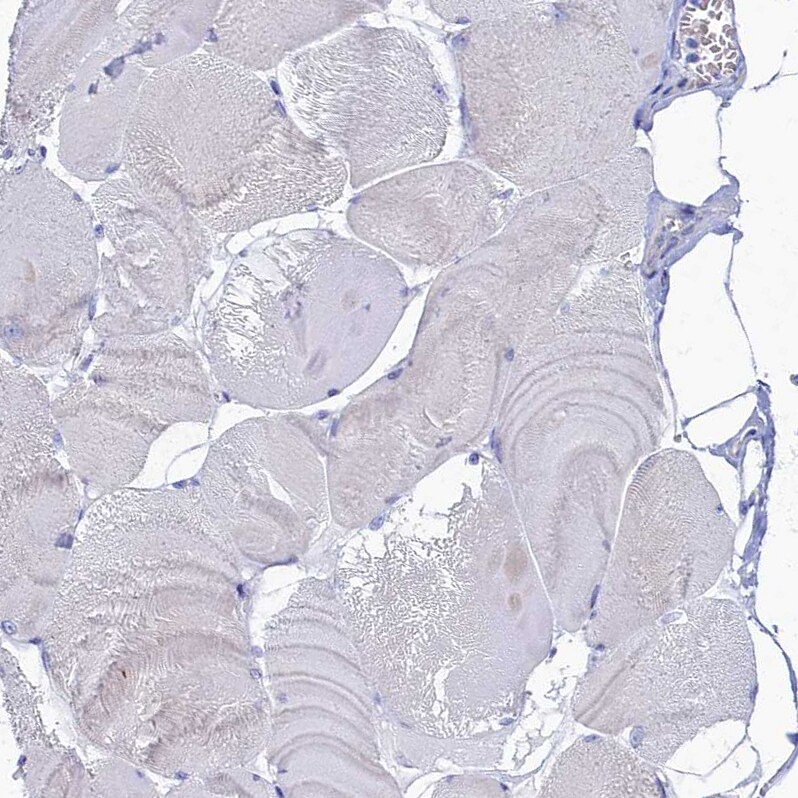 OCIAD2 Antibody - BSA Free Immunohistochemistry-Paraffin: OCIAD2 Antibody [NBP1-82683]