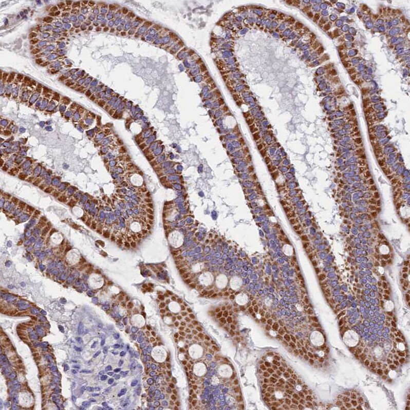 OCIAD2 Antibody - BSA Free Immunohistochemistry-Paraffin: OCIAD2 Antibody [NBP1-82683]