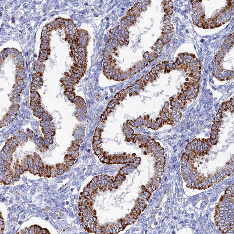 OCIAD2 Antibody - BSA Free Immunohistochemistry-Paraffin: OCIAD2 Antibody [NBP1-82683]