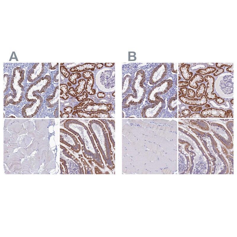 OCIAD2 Antibody - BSA Free Immunohistochemistry-Paraffin: OCIAD2 Antibody [NBP1-82683]