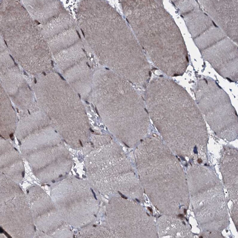 HDDC3 Antibody - BSA Free Immunohistochemistry-Paraffin: HDDC3 Antibody [NBP1-82684]