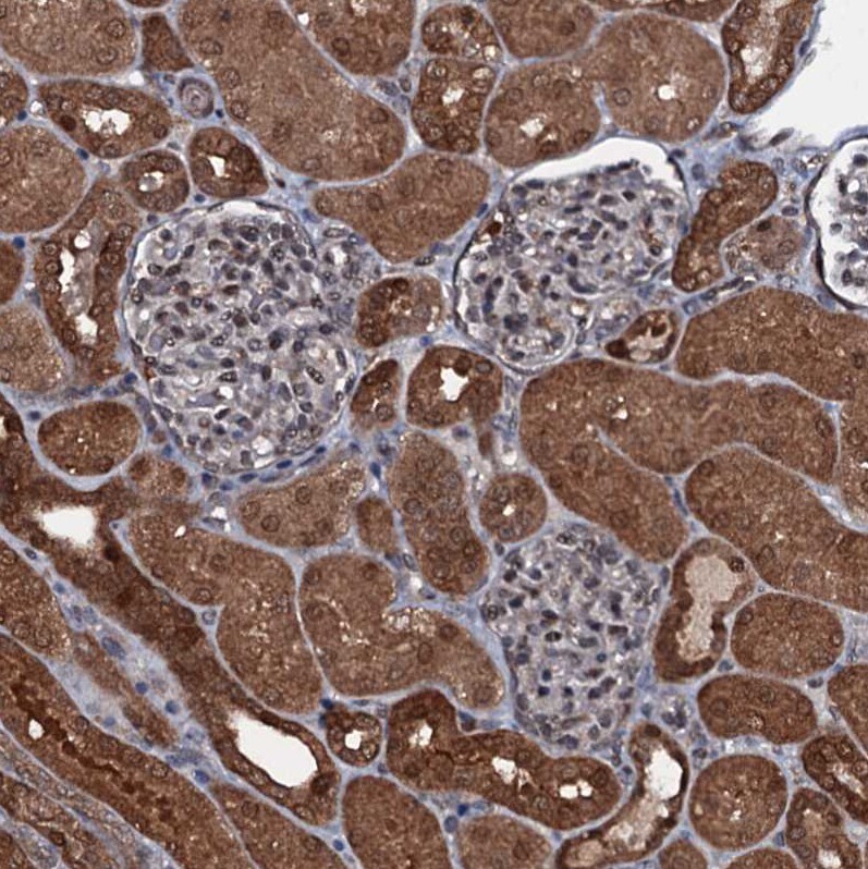 HDDC3 Antibody - BSA Free Immunohistochemistry-Paraffin: HDDC3 Antibody [NBP1-82684]
