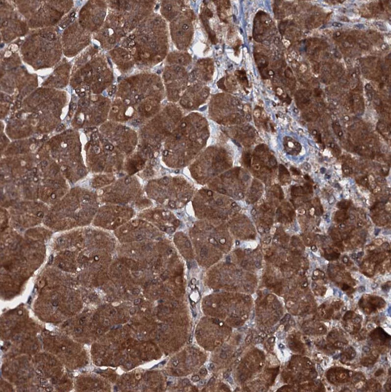 HDDC3 Antibody - BSA Free Immunohistochemistry-Paraffin: HDDC3 Antibody [NBP1-82684]