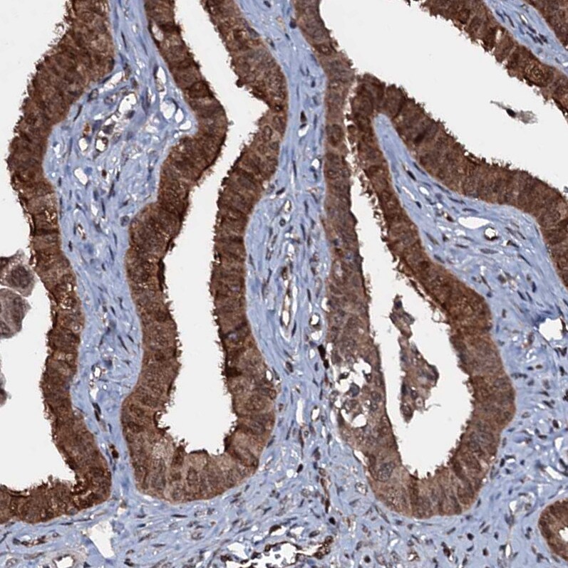 HDDC3 Antibody - BSA Free Immunohistochemistry-Paraffin: HDDC3 Antibody [NBP1-82684]