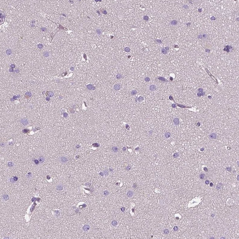 EFCAB4B Antibody - BSA Free Immunohistochemistry: EFCAB4B Antibody - BSA Free [NBP1-82687]