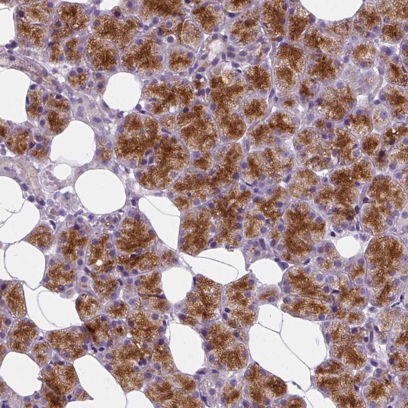 EFCAB4B Antibody - BSA Free Immunohistochemistry: EFCAB4B Antibody - BSA Free [NBP1-82687]