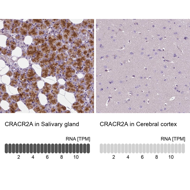 EFCAB4B Antibody - BSA Free Immunohistochemistry: EFCAB4B Antibody - BSA Free [NBP1-82687]