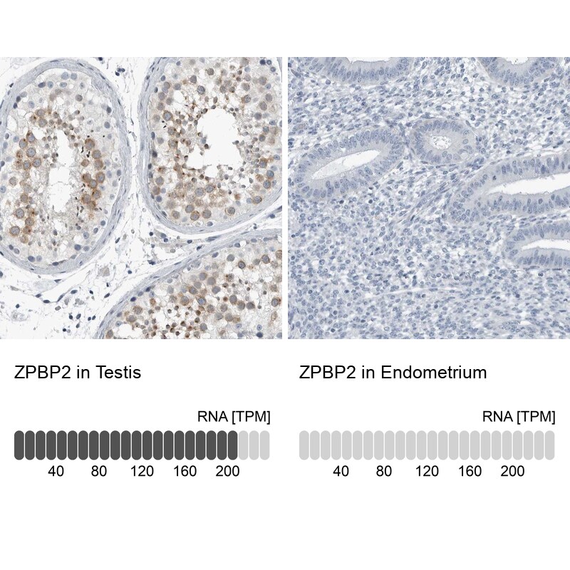 ZPBP2 Antibody - BSA Free Immunohistochemistry-Paraffin: ZPBP2 Antibody [NBP1-82689]