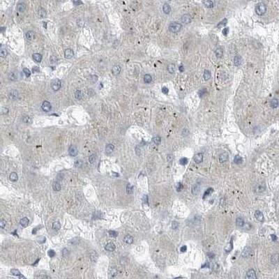 ZPBP2 Antibody - BSA Free Immunohistochemistry-Paraffin: ZPBP2 Antibody [NBP1-82689]