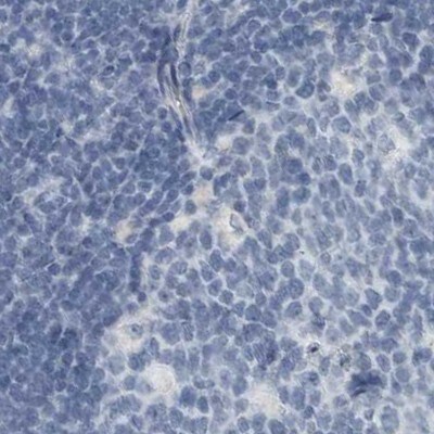ZPBP2 Antibody - BSA Free Immunohistochemistry-Paraffin: ZPBP2 Antibody [NBP1-82689]
