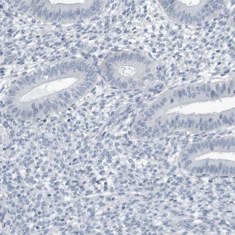ZPBP2 Antibody - BSA Free Immunohistochemistry-Paraffin: ZPBP2 Antibody [NBP1-82689]