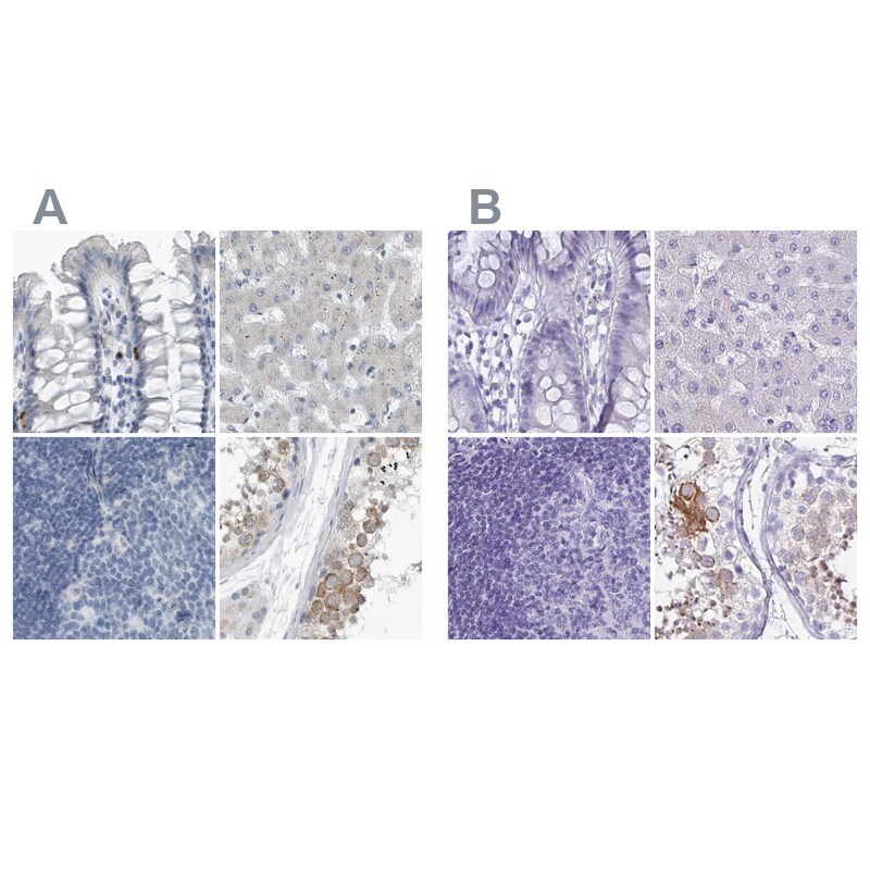 ZPBP2 Antibody - BSA Free Immunohistochemistry-Paraffin: ZPBP2 Antibody [NBP1-82689]