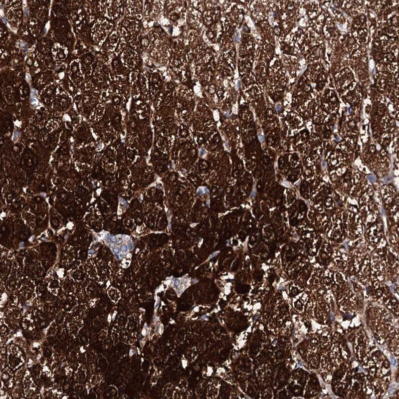 AMDHD1 Antibody - BSA Free Immunohistochemistry-Paraffin: AMDHD1 Antibody [NBP1-82701]