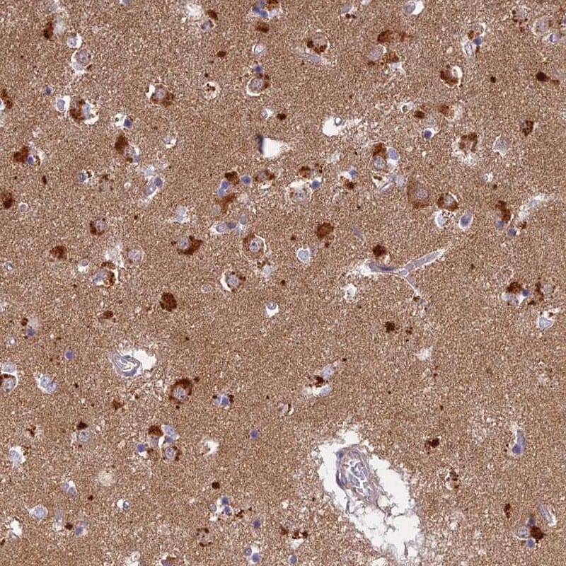 LYSMD2 Antibody - BSA Free Immunohistochemistry-Paraffin: LYSMD2 Antibody [NBP1-82702]