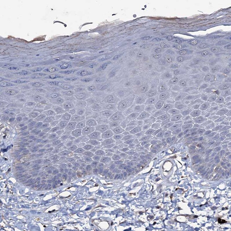 WDR66 Antibody - BSA Free Immunohistochemistry-Paraffin: WDR66 Antibody [NBP1-82711]