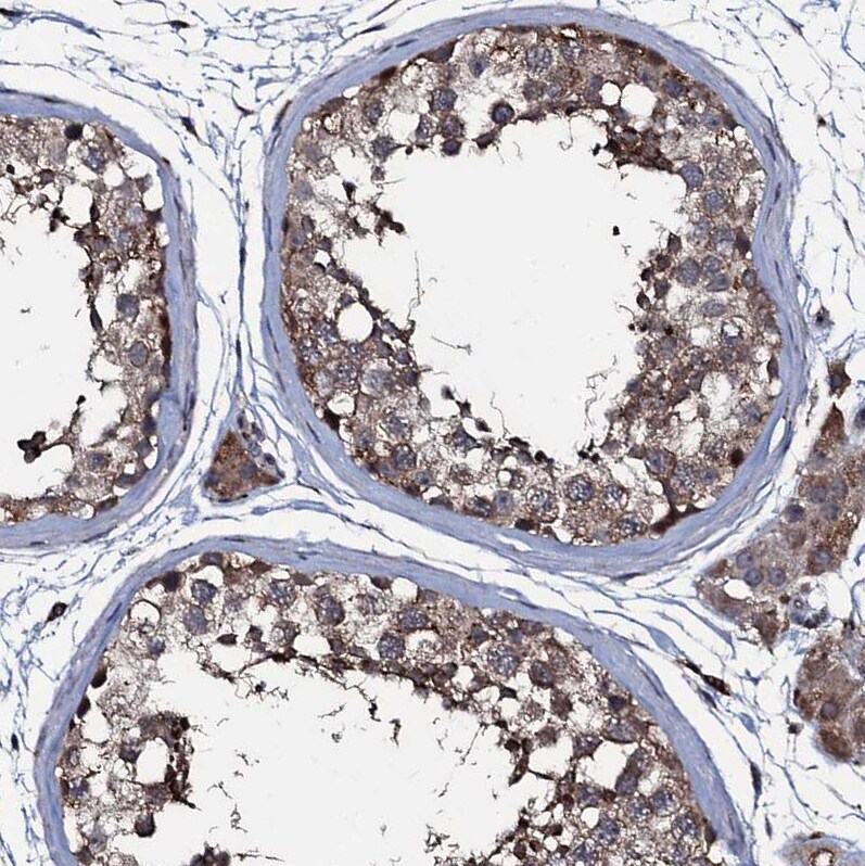 WDR66 Antibody - BSA Free Immunohistochemistry-Paraffin: WDR66 Antibody [NBP1-82711]