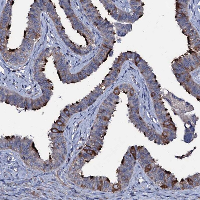 WDR66 Antibody - BSA Free Immunohistochemistry-Paraffin: WDR66 Antibody [NBP1-82711]