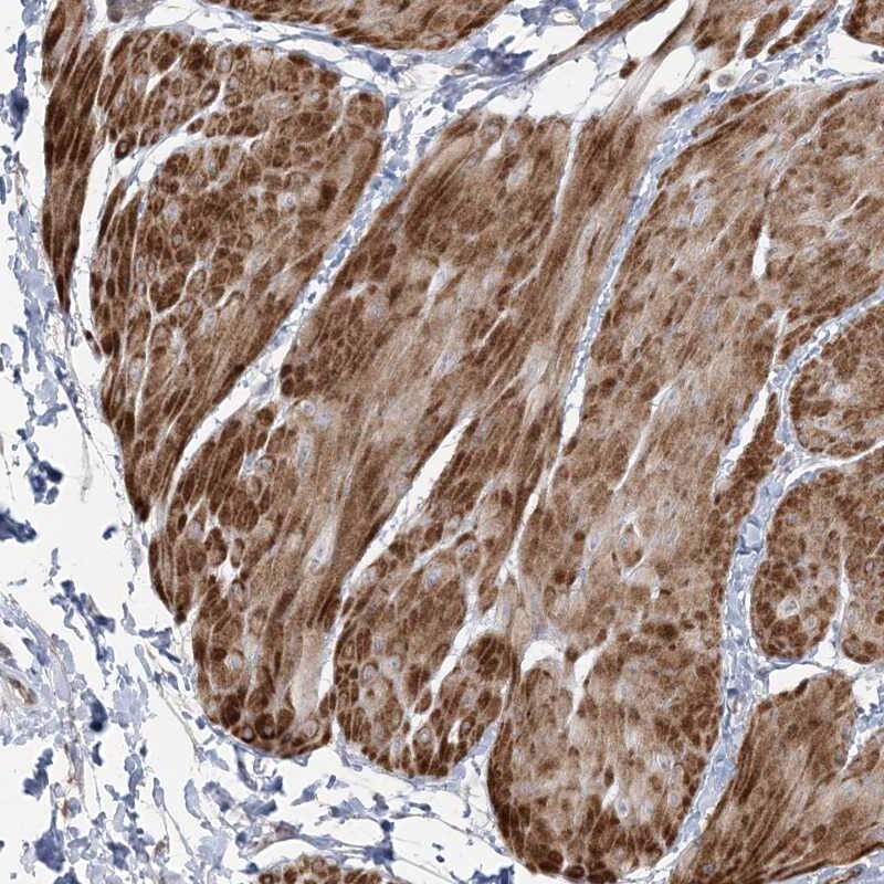 NUDT9 Antibody - BSA Free Immunohistochemistry-Paraffin: NUDT9 Antibody [NBP1-82715]