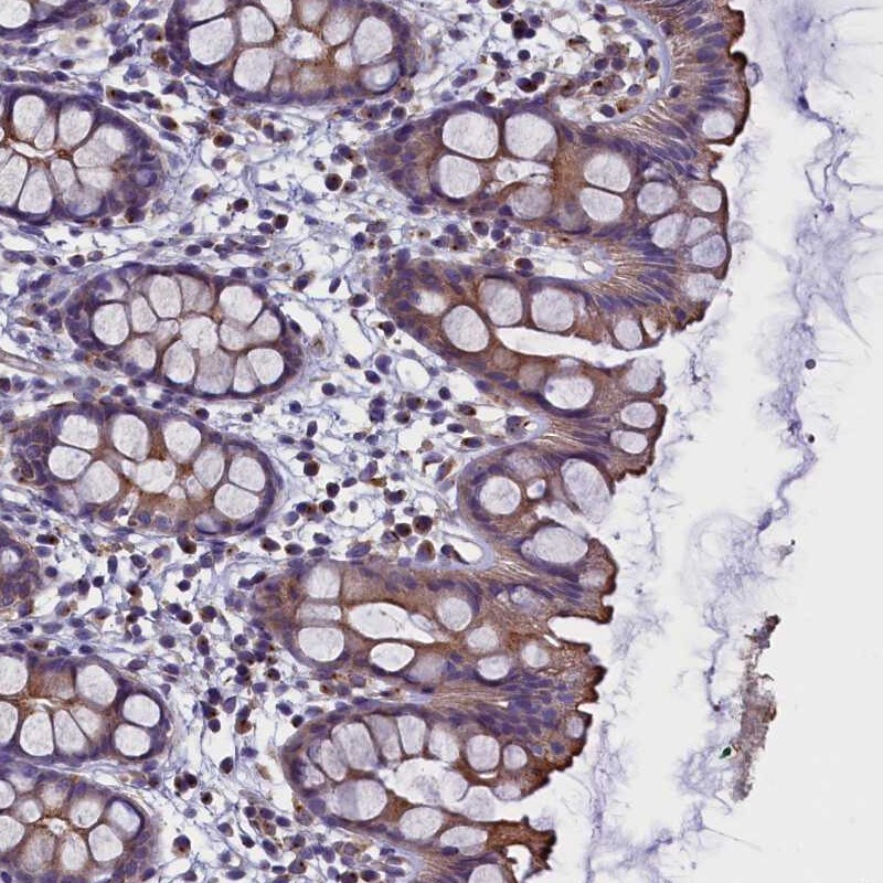 STK32A Antibody - BSA Free Immunohistochemistry: STK32A Antibody - BSA Free [NBP1-82735]