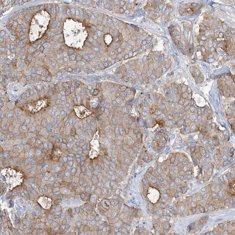 ADCK2 Antibody - BSA Free Immunohistochemistry: ADCK2 Antibody - BSA Free [NBP1-82736]