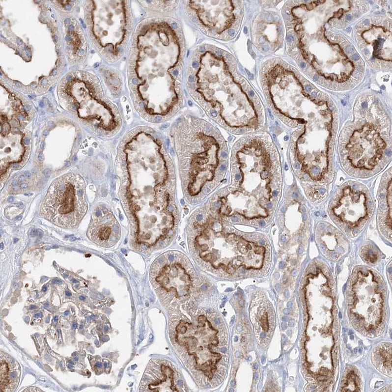 ADCK2 Antibody - BSA Free Immunohistochemistry: ADCK2 Antibody - BSA Free [NBP1-82736]